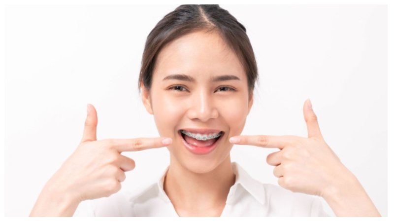Orthodontic Treatment